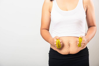 女人部分产后疤痕测量腰拉伸马克宽松的较低的腹部皮肤脂肪怀<strong>孕婴</strong>儿出生