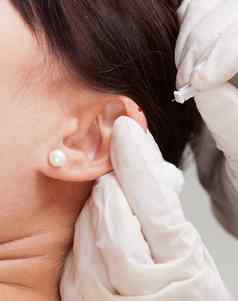 耳针灸细节