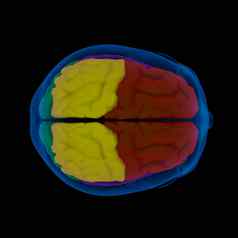 彩色的部分人类brain-cerebrum前视图