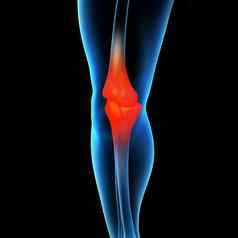 人类膝盖疼痛解剖学骨架腿