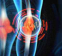 人类膝盖疼痛解剖学骨架腿