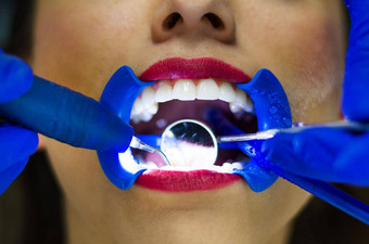 周期全面的牙科检查健康的牙齿