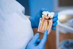 假生病的牙龋齿牙医显示结构牙齿