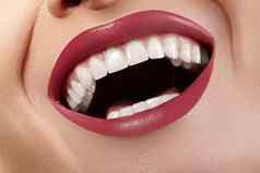 宏快乐女微笑健康的白色牙齿明亮的红色的嘴唇化妆口腔学美治疗美白