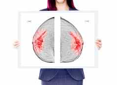 乳房癌症意识女人战斗乳房癌症海报显示x射线数字乳房x光检查孤立的白色背景剪裁路径
