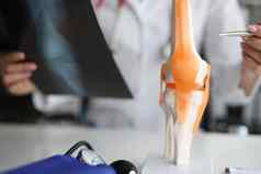 医生显示解剖学膝盖联合x射线