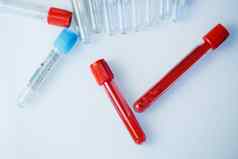 测试管血分析检查病毒医疗设备