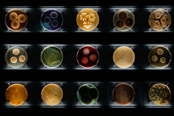 类型细菌模具真菌佩特里菜