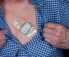 小可移植的心电图心函数监控附加高级胸部