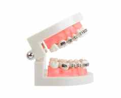 牙齿模型金属线牙科牙套牙科仪器孤立的白色背景保存剪裁路径