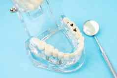 健康的腐烂的牙齿模型口镜子牙科概念