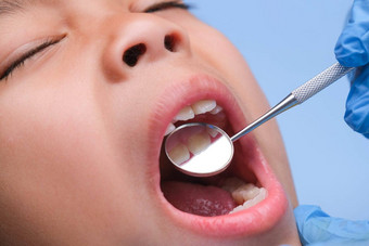 特写镜头口服腔健康的孩子美丽的白色牙齿年轻的女孩打开口揭示健康的牙齿硬软口感牙科口服健康检查