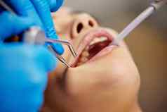 健康的牙齿精心制作年轻的女人牙科过程执行