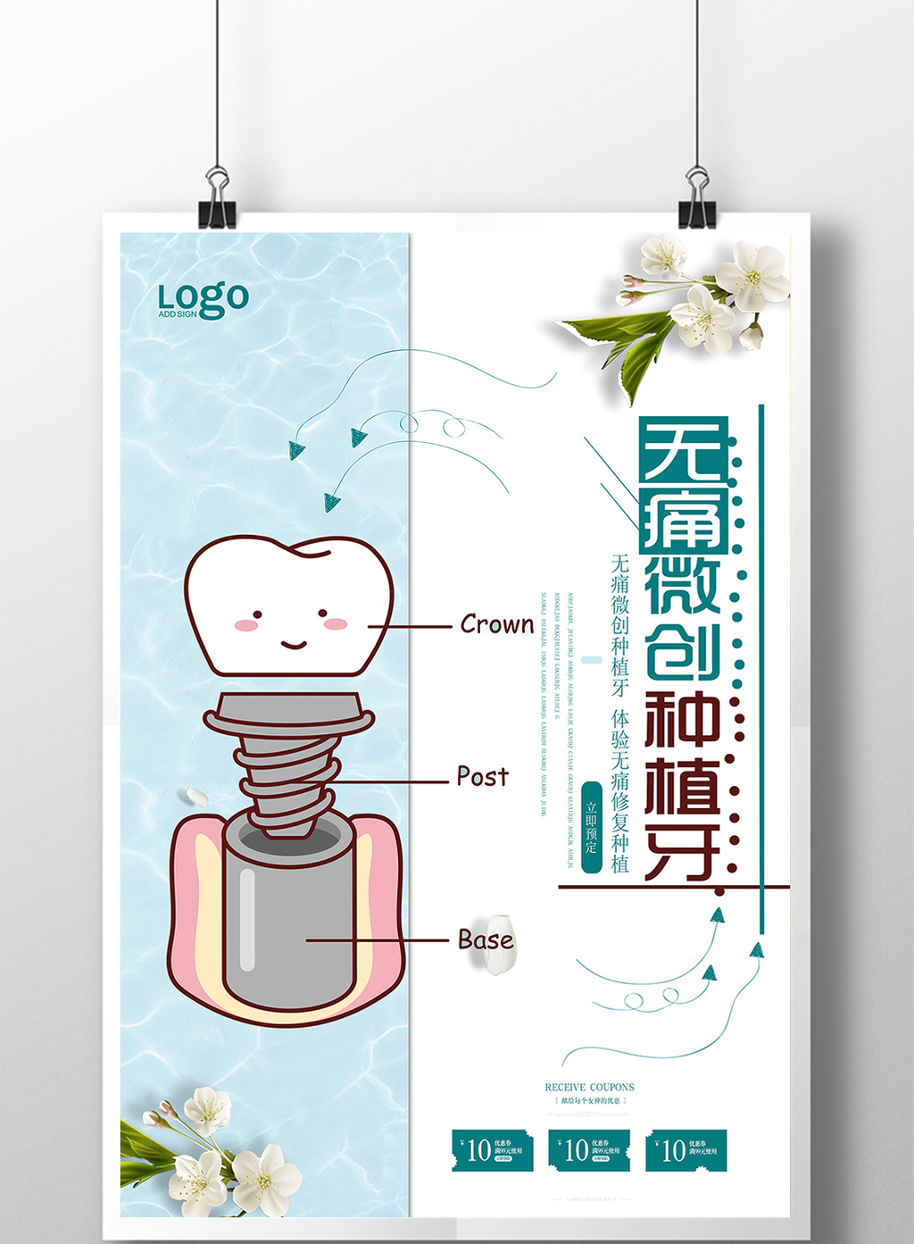 小清新无痛微创种植牙宣传海报设计