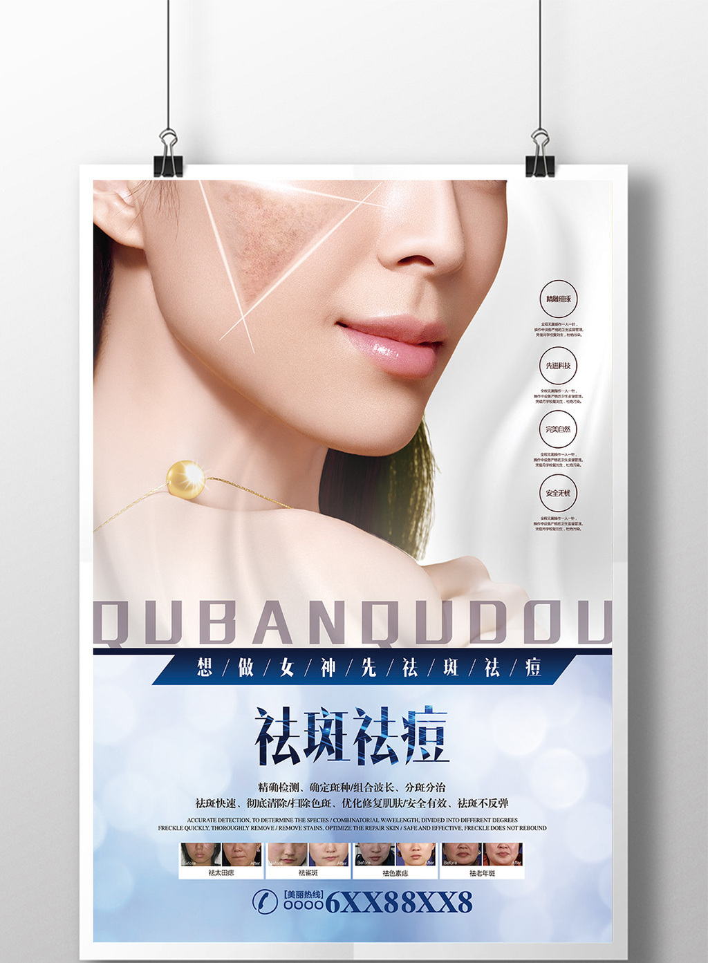 祛斑祛痘祛痣美容微整形宣传海报高清psd图片设计素材