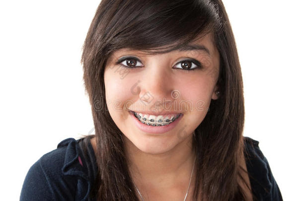 可爱的拉丁女孩戴着牙套微笑