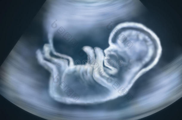 胎儿在母亲子宫内的超声图像