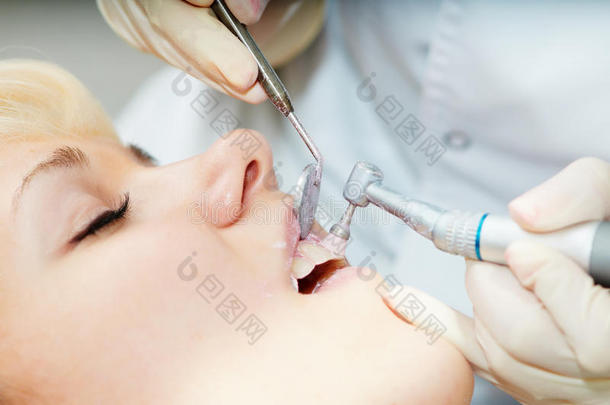 牙医保健牙齿抛光工作