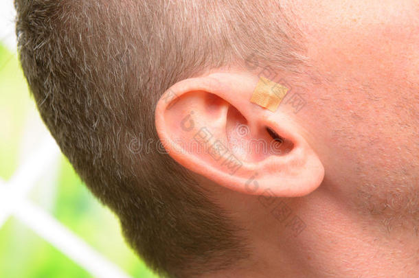 耳穴疗法