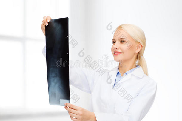 微笑着看x光片的女医生