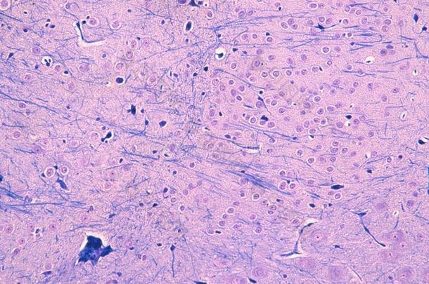 lfb/cv脑髓鞘和nissel物质的组织学研究