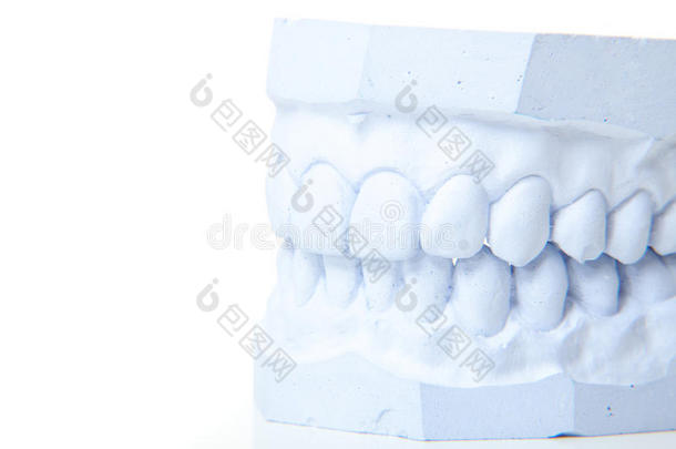 石膏铸成的完美牙齿