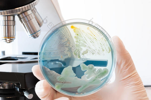 铜绿假单胞菌琼脂分析化验细菌