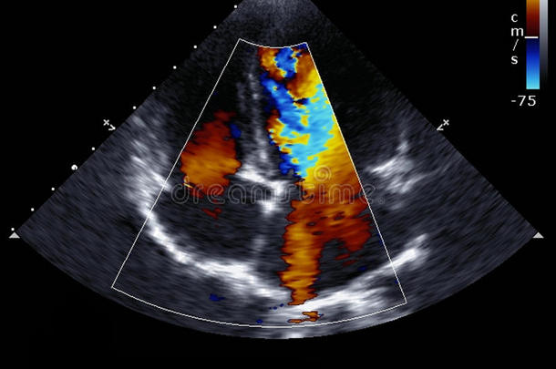 [医]多普勒回声心动描记术，多普勒回波心动描记术;