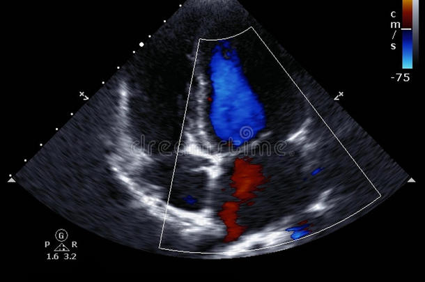 [医]多普勒回声心动描记术，多普勒回波心动描记术;