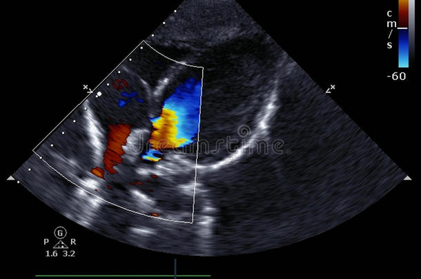 [医]多普勒回声心动描记术，多普勒回波心动描记术;