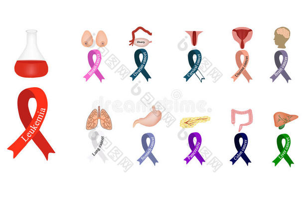 癌症丝带。 一组不同颜色的丝带对<strong>抗癌</strong>症。 国际癌症<strong>日</strong>。 世界癌症<strong>日</strong>。