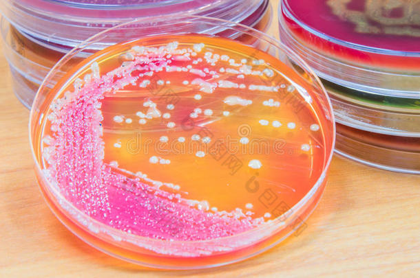 琼脂平板上的细菌培养生长。