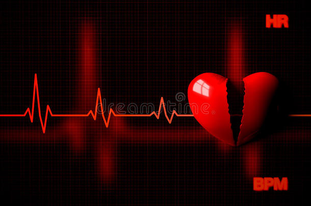 击败破碎的心电图心脏病学图表