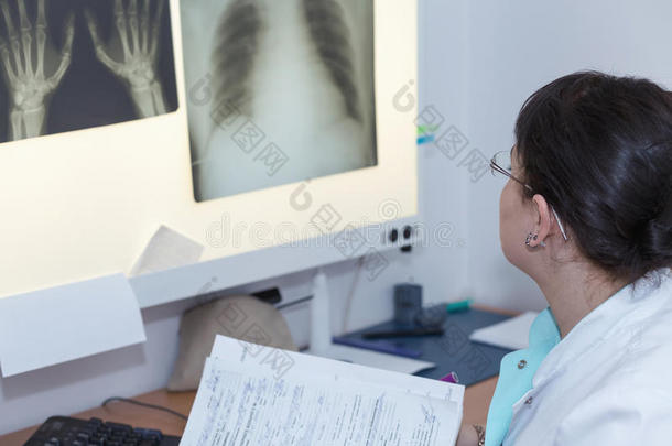女医生在检查x光片