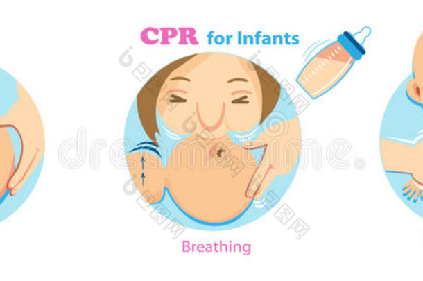 CPR婴儿