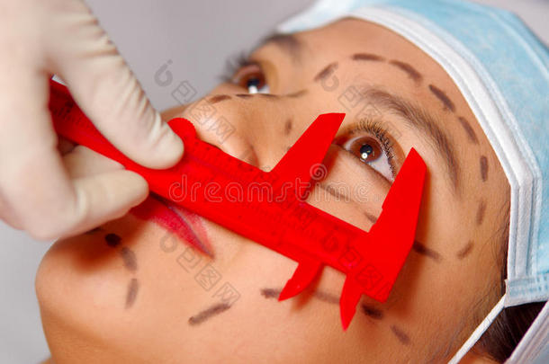 特写年轻妇女的脸准备整容手术与线绘制在皮肤上，医生测量使用红色工具，作为