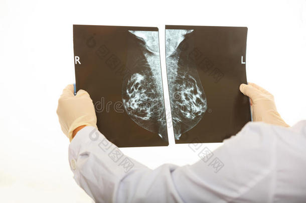 医生在白色背景上做乳房X线检查