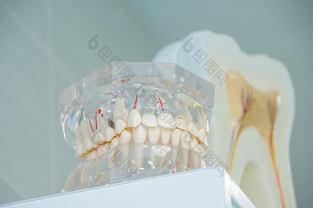 清洁<strong>牙齿</strong>义齿，<strong>牙齿</strong>切割，<strong>牙齿</strong>模型，在牙医`办公室。