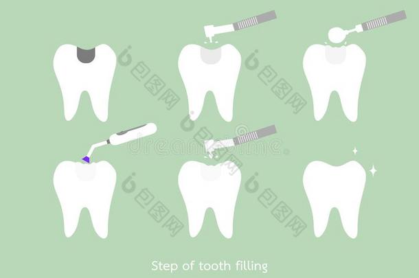 步关于龋齿向向oth汞合金装满和牙齿的向ols