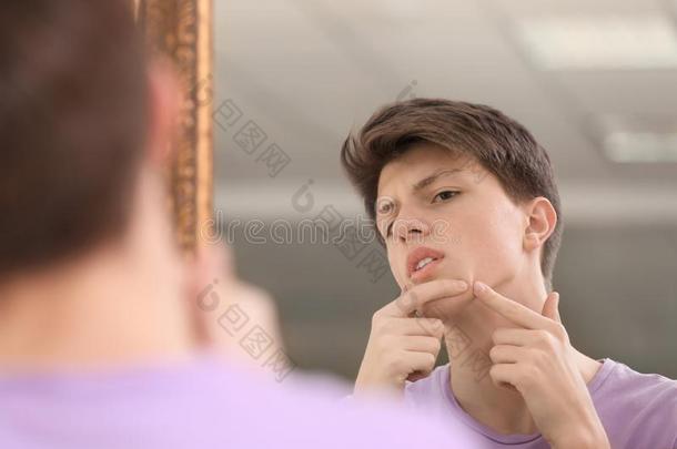 十几岁的男孩和痤疮问题有样子的采用镜子