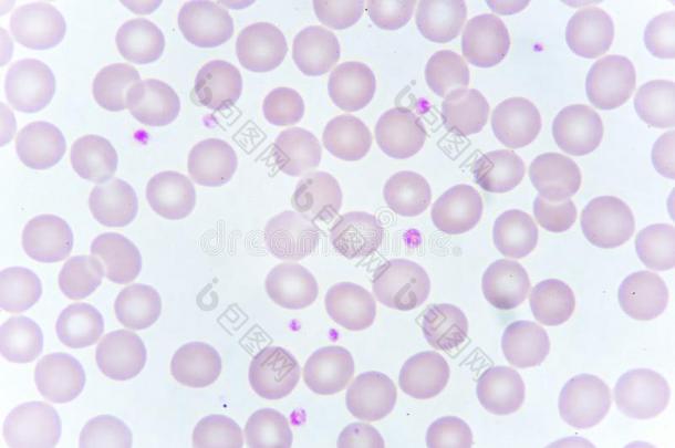 红色的血细胞和血小板采用血涂抹