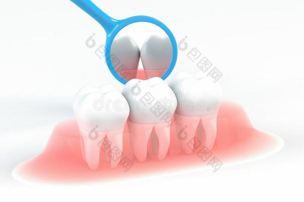 牙齿的检查关于牙齿的龋齿