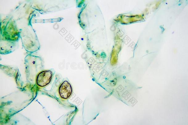 鱼腥藻异形胞
