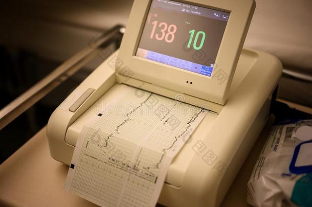 心分娩力描记法：分娩过程中监测胎儿心率和子宫收缩的方法机器关于医院和显示屏和图表