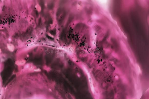 癌症细胞在下面一显微镜.组织一ffected在旁边c一ncer细胞