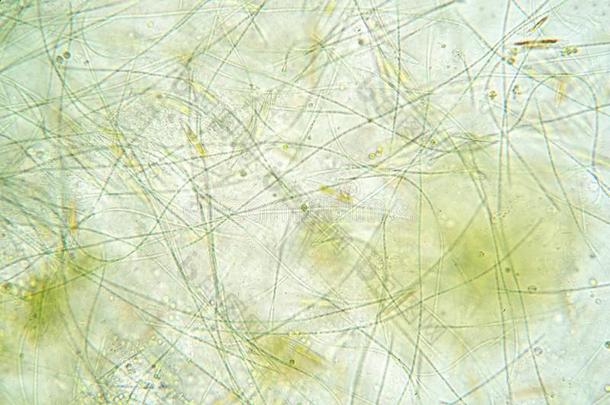 细丝状的水藻是单一的水藻细胞det.那个形状长的看得见的