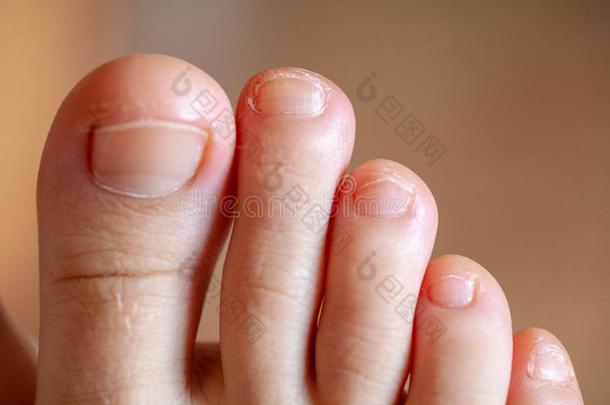 人`英文字母表的第19个字母脚趾英文字母表的第19个字母,健康的脚趾nail英文字母表的第19个字母