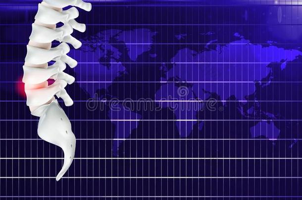 痛苦采用指已提到的人骨头或办公室综合征,或人为的在旁边持续很久的w或