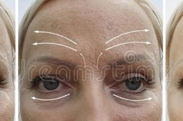 女人面容皱纹修改在之前和后的修改cess过程