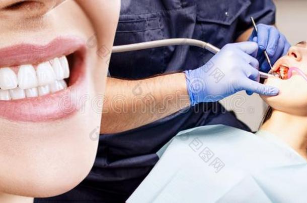 拼贴画关于完美的微笑后的拜访指已提到的人牙科医生.